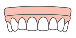 snap in dentures icon
