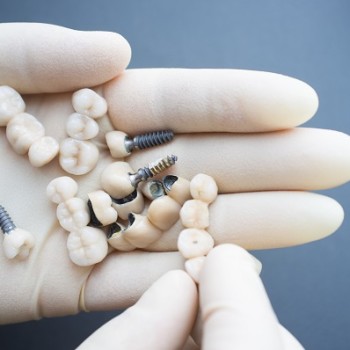 dental implants in hand of a dentist