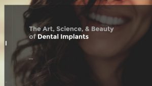 the art, science, and beauty of dental implants