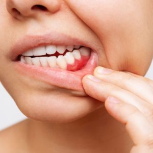 gums affected by infections